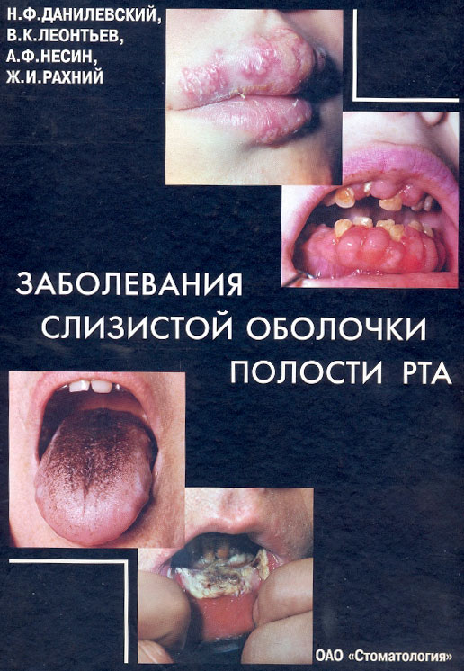 Заболевания слизистой оболочки полости рта. Н.Ф.Данилевский, В.К.Леонтьев, А.Ф.Несин, Ж.И.Рахний